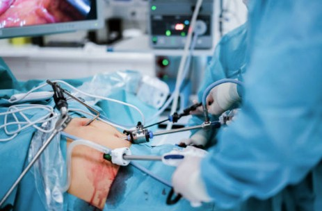 The Best Plan for your Bariatric Surgery (Simple Guide) 2026